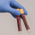 A full color image of a gloved hand holding two yellow-lidded vials of blood.